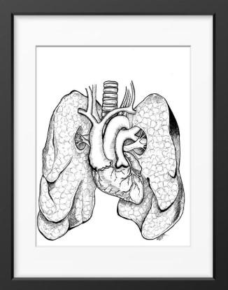 Anatomical Anomalies