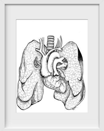 Anatomical Anomalies