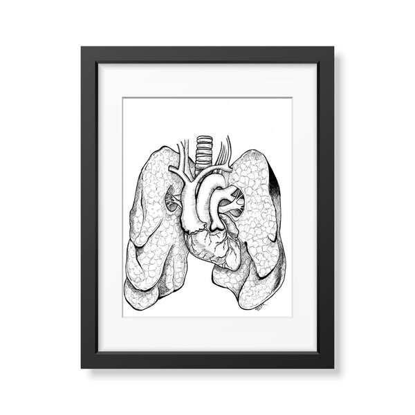 Anatomical Anomalies