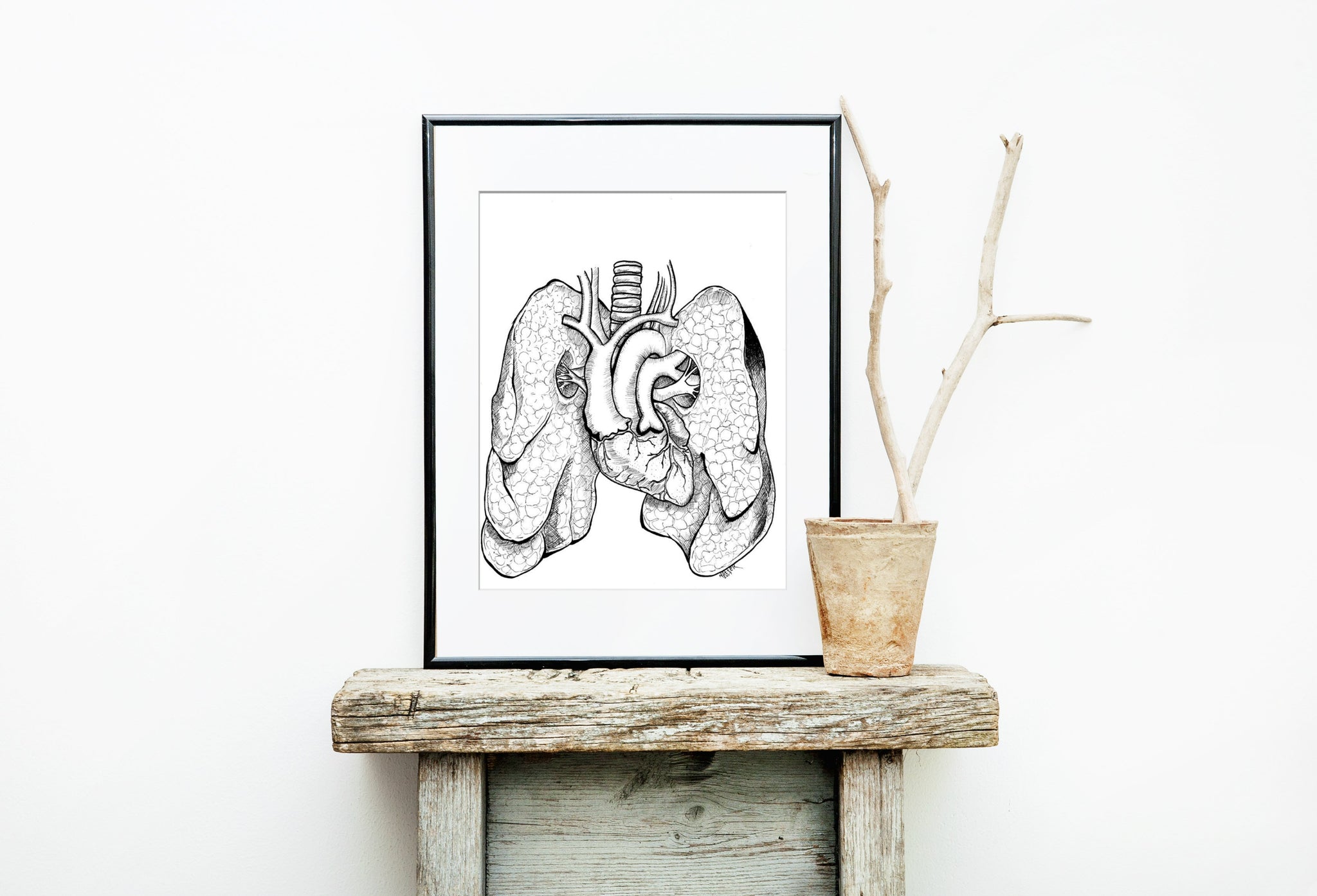 Anatomical Anomalies