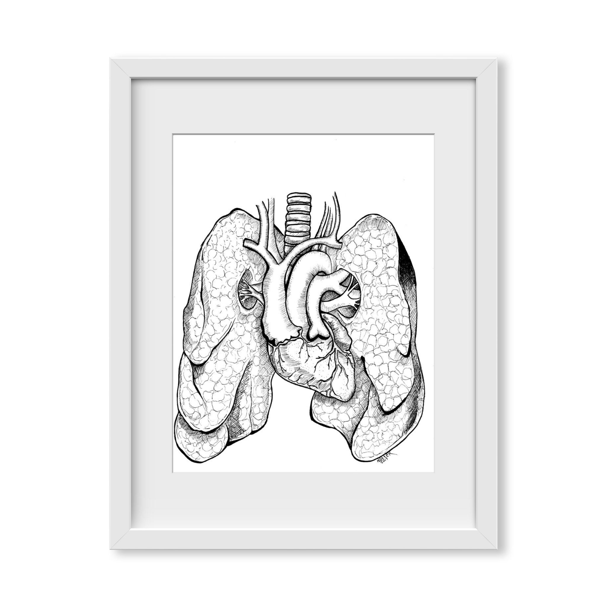 Anatomical Anomalies