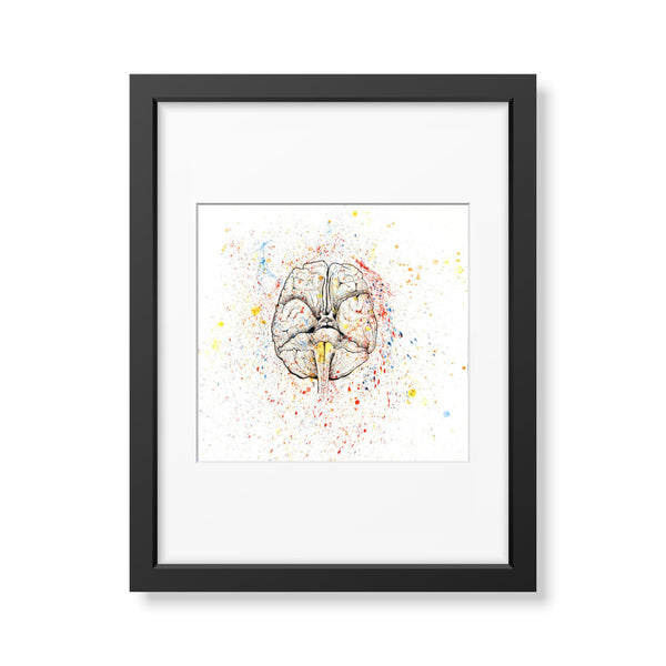 Anatomical Brain Splatter