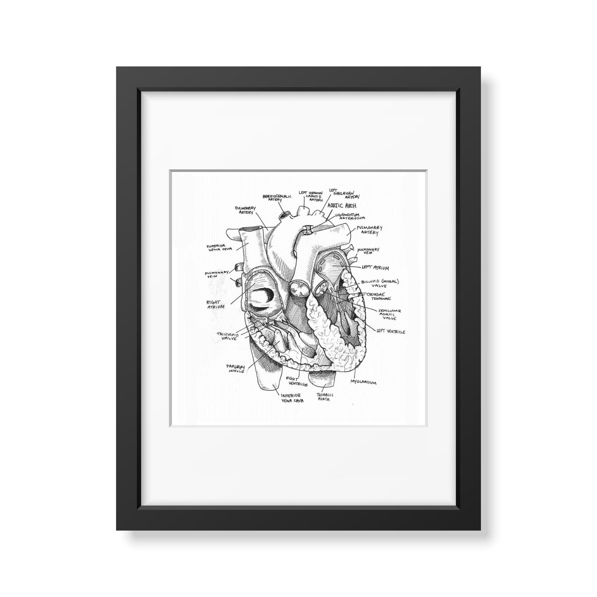 Heart Anatomy
