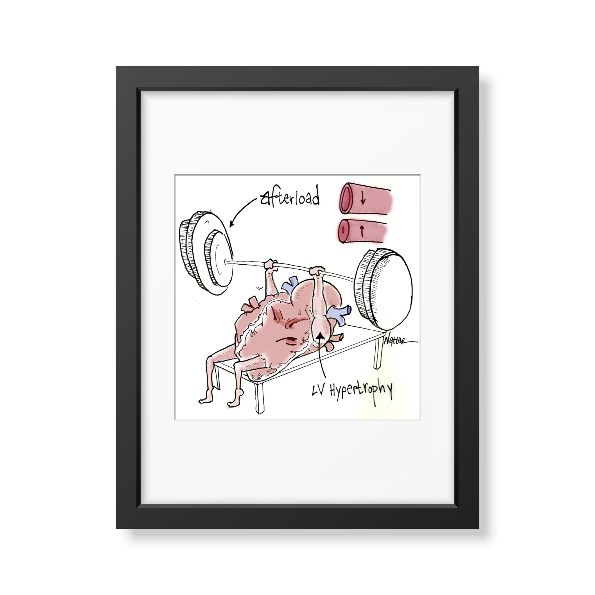 Heart Pump Afterload