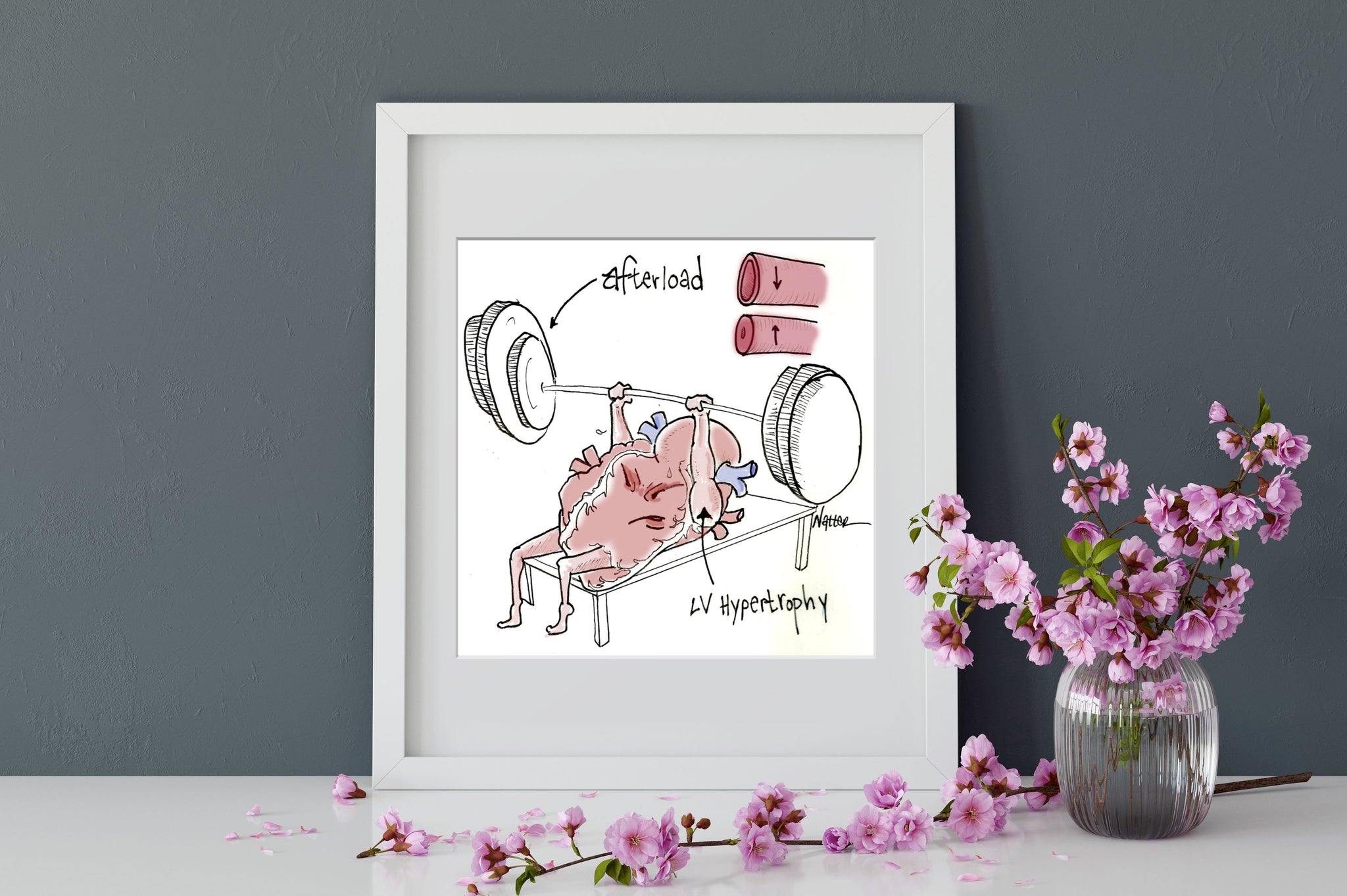 Heart Pump Afterload