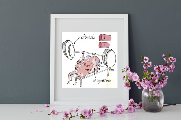 Heart Pump Afterload