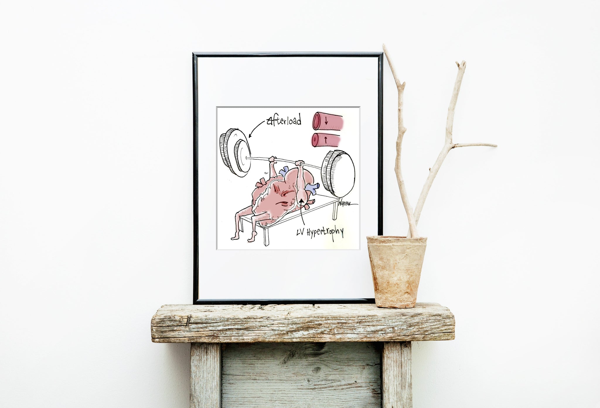 Heart Pump Afterload