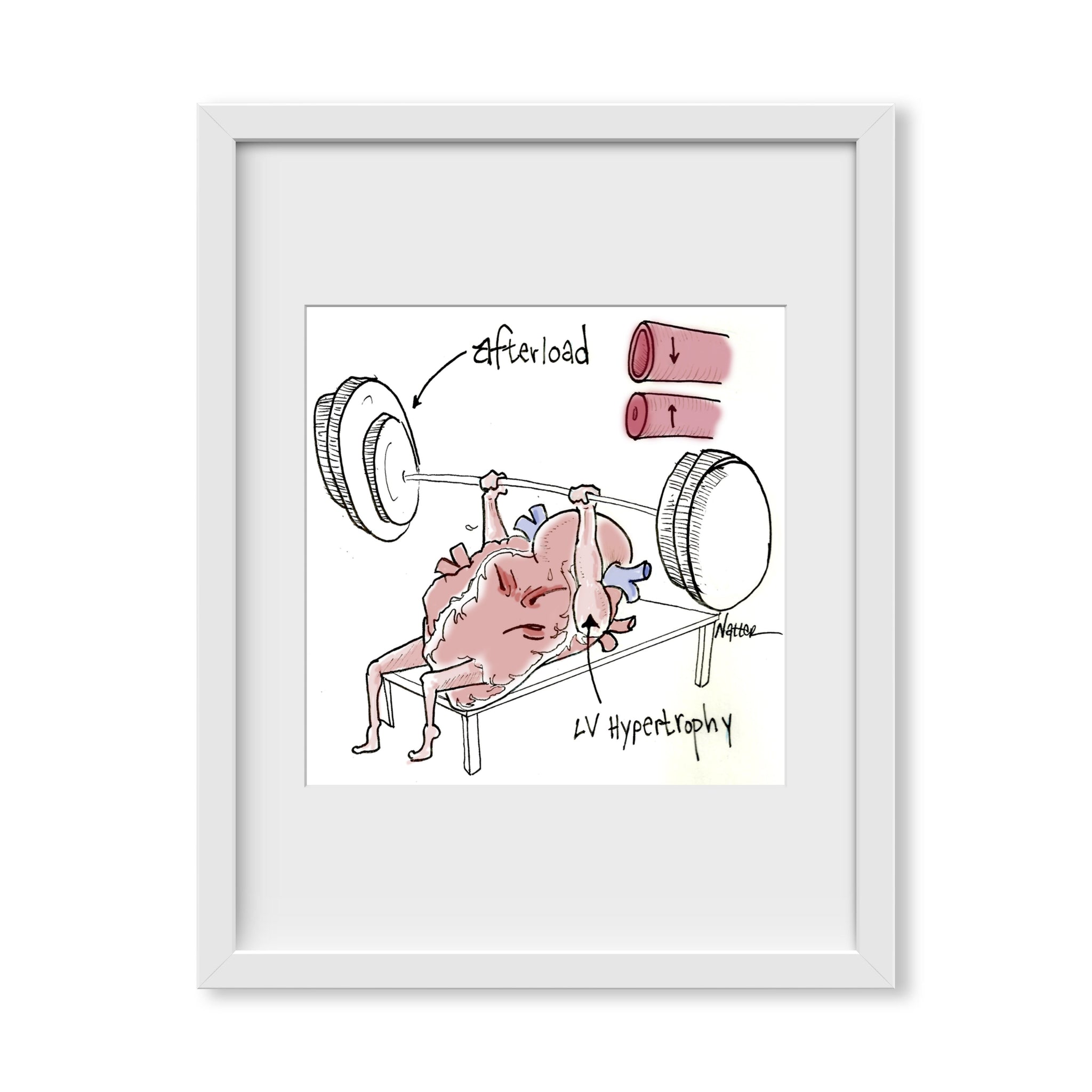 Heart Pump Afterload