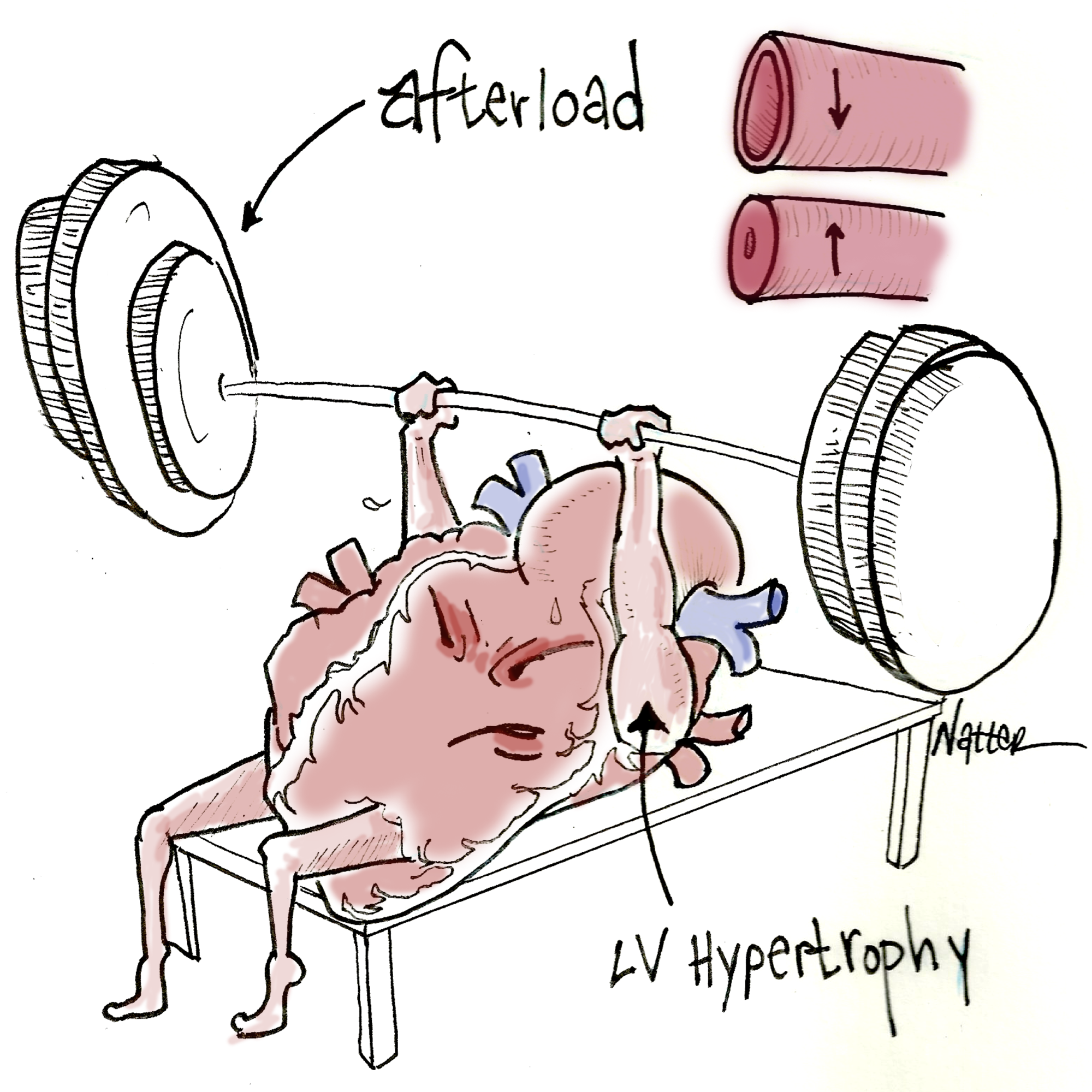 Heart Pump Afterload