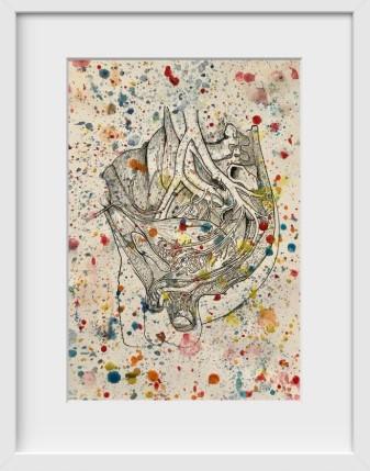 Splatter Anatomical Urology