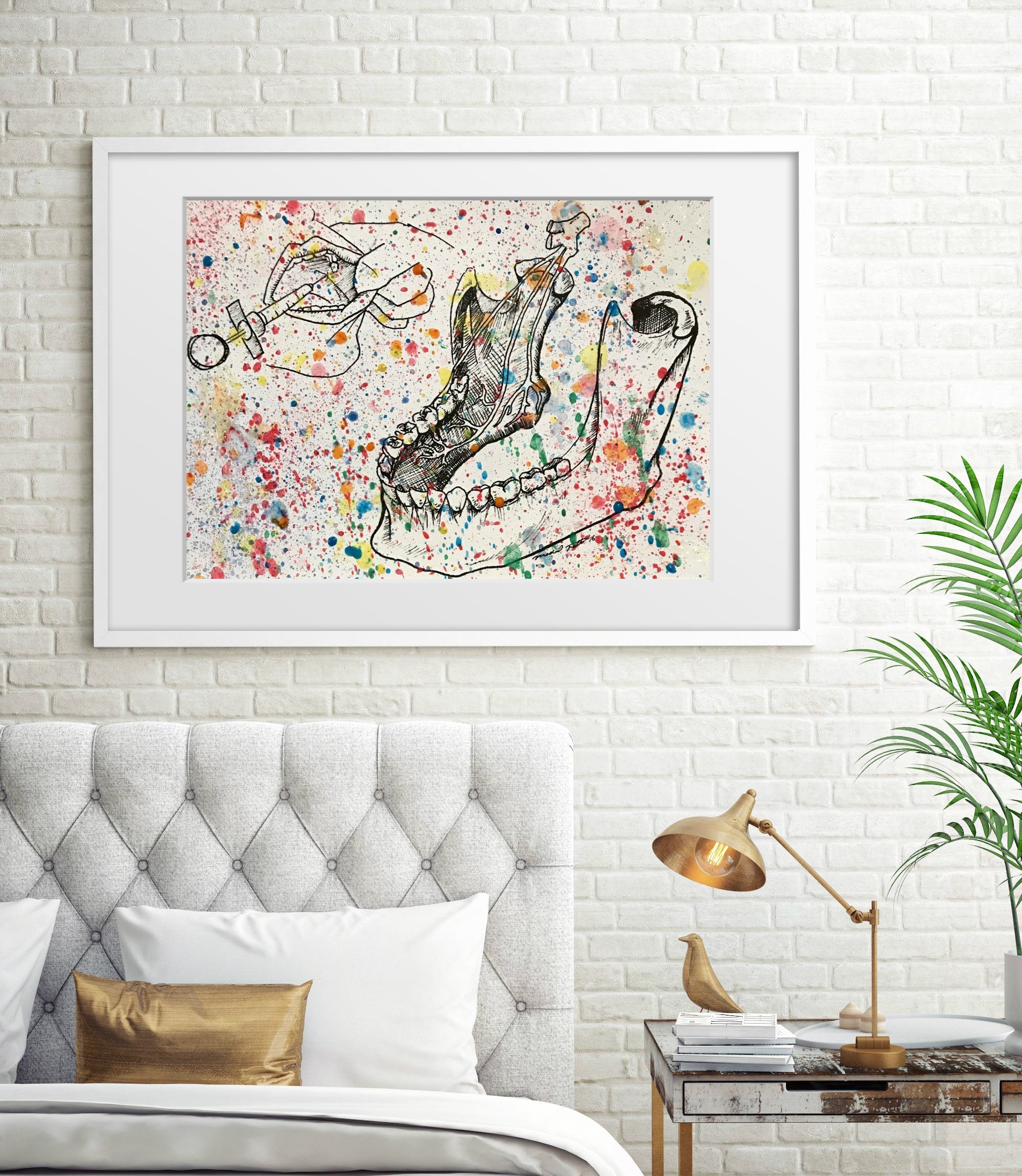 Splatter Inferior Alveolar Nerve