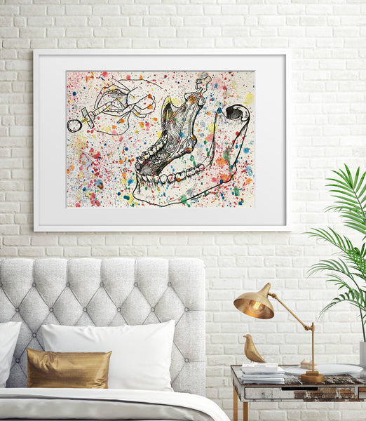 Splatter Inferior Alveolar Nerve